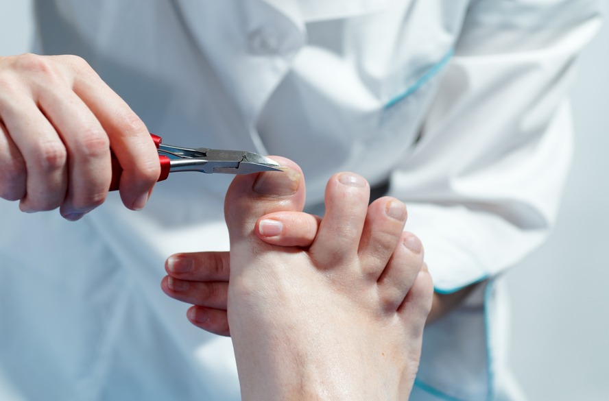 Tesoura, alicate ou cortador: com qual cortar as unhas?