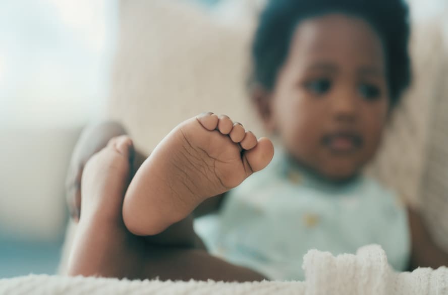 Pé chato em crianças: é preciso corrigir?