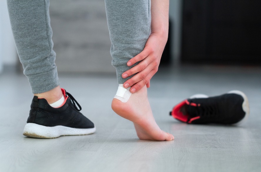 Bolha estourou? Aprenda a fazer o curativo ideal