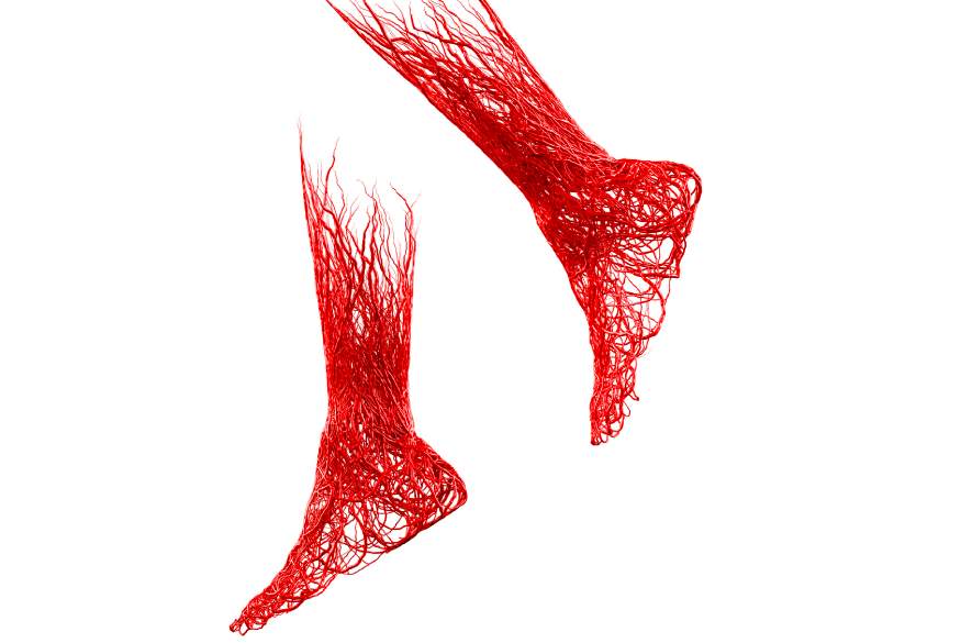 Problemas de circulação e os pés: qual é a relação?